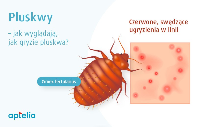 Ślad po ugryzieniu pluskwy – jak go rozpoznać?